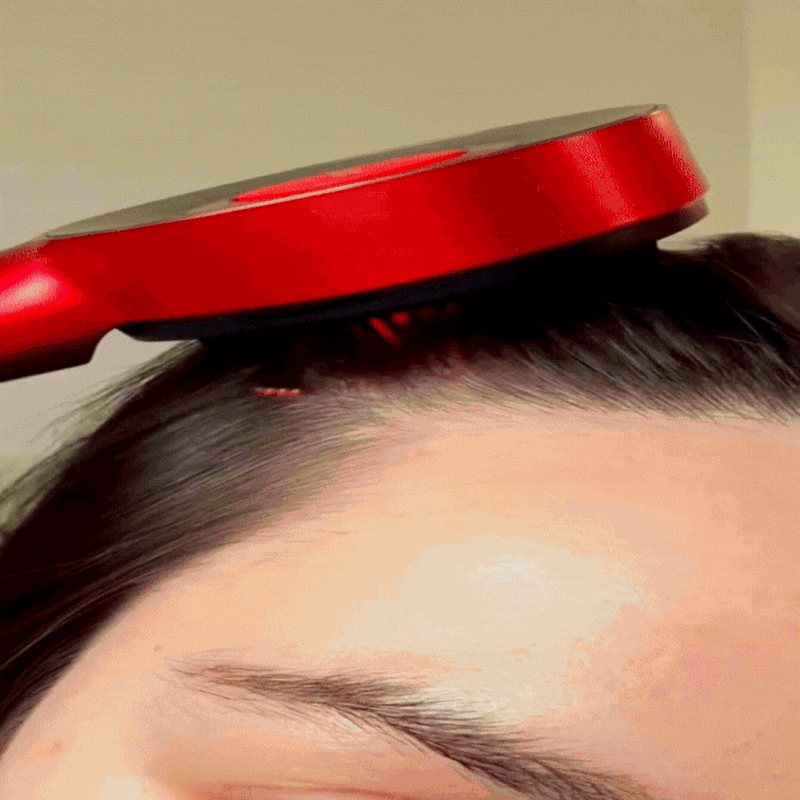Wildora Scalp Renew Brush – Stop Hair Loss & Regrow Thicker Hair in 8 Weeks