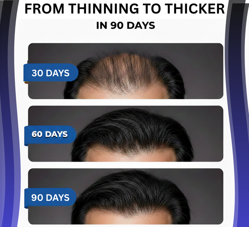 Hair Fall? Thinning? – Secret Root Activating Shampoo 100ml for Men & Women | Strong, Thick Hair!